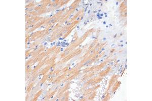 Immunohistochemistry of paraffin-embedded rat heart using PDCD2L antibody (ABIN6130653, ABIN6145336, ABIN6145337 and ABIN6223261) at dilution of 1:100 (40x lens). (PDCD2L anticorps  (AA 1-358))
