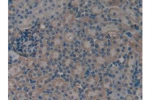 Detection of S100A11 in Rat Kidney Tissue using Polyclonal Antibody to S100 Calcium Binding Protein A11 (S100A11)