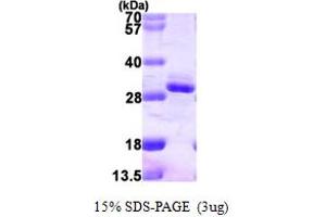 SDS-PAGE (SDS) image for Regulator of G-Protein Signaling 2 (RGS2) (AA 1-211) protein (His tag) (ABIN7279374)