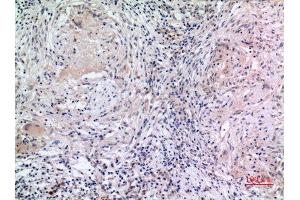 Immunohistochemistry (IHC) analysis of paraffin-embedded Human Lung, antibody was diluted at 1:100.