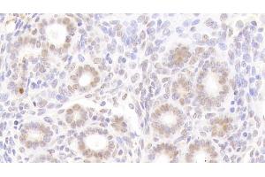 Detection of NUP88 in Mouse Uterus Tissue using Polyclonal Antibody to Nucleoporin 88 (NUP88) (NUP88 anticorps  (AA 57-296))