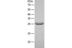 Western Blotting (WB) image for Abhydrolase Domain Containing 10 (ABHD10) (AA 53-306) protein (His-IF2DI Tag) (ABIN7121635)