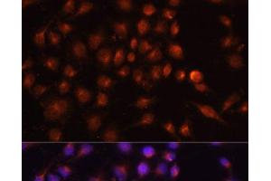 Immunofluorescence analysis of HeLa cells using RAB11A Polyclonal Antibody at dilution of 1:100. (RAB11A anticorps)