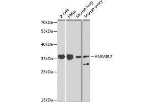 Western blot analysis of extracts of various cell lines, using L2 antibody (ABIN6129912, ABIN6136940, ABIN6136941 and ABIN6223557) at 1:1000 dilution. (ANXA8L2 anticorps  (AA 1-276))