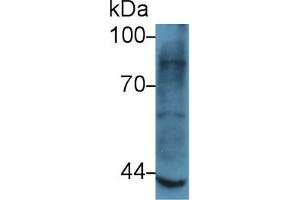 Western Blot; Sample: Rat Skeletal muscle lysate; Primary Ab: 5µg/ml Rabbit Anti-Human MMP3 Antibody Second Ab: 0.