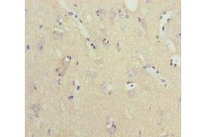 Immunohistochemistry of paraffin-embedded human brain tissue using ABIN7161439 at dilution of 1:100 (NPTN anticorps  (AA 29-200))