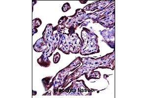 CEAC Antibody (C-term) ((ABIN657776 and ABIN2846751))immunohistochemistry analysis in formalin fixed and paraffin embedded human placenta tissue followed by peroxidase conjugation of the secondary antibody and DAB staining.