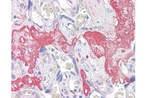 Anti-GAGED2 antibody IHC of human placenta. (XAGE1D anticorps  (AA 58-69))