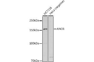 Western blot analysis of extracts of various cell lines, using  antibody (ABIN6129706, ABIN6136901, ABIN6136902 and ABIN6214776) at 1:1000 dilution. (ANO1 anticorps  (AA 628-731))