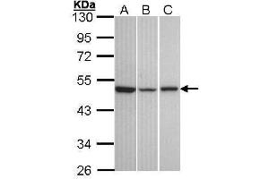 WB Image Sample (30 ug of whole cell lysate) A: A431 , B: Hela C: Hep G2 , 10% SDS PAGE antibody diluted at 1:1000 (KISS1R anticorps  (C-Term))
