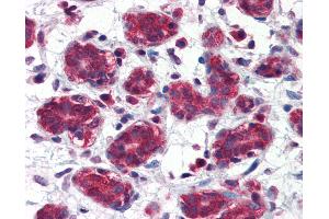 Anti-FOLH1 / PSMA antibody IHC of human breast. (PSMA anticorps  (AA 117-351))