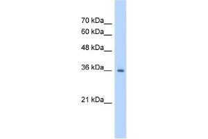 RSU1 antibody used at 1. (RSU1 anticorps  (C-Term))