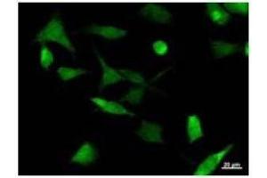 Immunostaining analysis in HeLa cells.