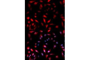 Immunofluorescence analysis of U2OS cell using Phospho-HSPB1-S82 antibody.