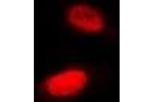 Immunofluorescent analysis of SHARP-2 staining in Hela cells. (BHLHE40 anticorps)