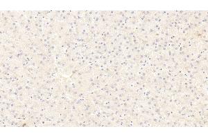 Detection of WNT11 in Human Liver Tissue using Monoclonal Antibody to Wingless Type MMTV Integration Site Family, Member 11 (WNT11)