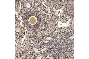 IHC analysis of U1A/SNRPA using anti-U1A/SNRPA antibody (ABIN7600891). (SNRPA1 anticorps  (AA 25-218))