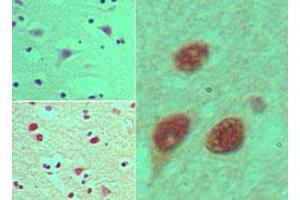 anti-Nucleoporin 35kDa (NUP35) (AA 280-330) antibody