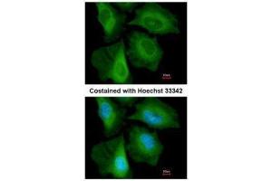 ICC/IF Image Immunofluorescence analysis of paraformaldehyde-fixed HeLa, using CacyBP, antibody at 1:200 dilution. (CACYBP anticorps  (C-Term))