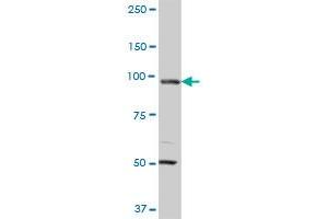 MCM3 monoclonal antibody (M01A), clone 4F7. (MCM3 anticorps  (AA 699-808))