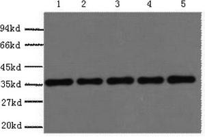 Western Blotting (WB) image for anti-Glyceraldehyde-3-Phosphate Dehydrogenase (GAPDH) antibody (ABIN5959504) (GAPDH anticorps)