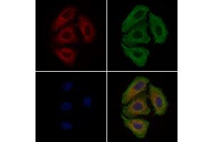 ABIN6260505 and ABIN6279264 staining Hela cells by IF/ICC.