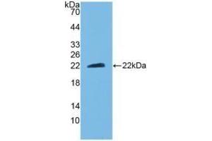 Detection of Recombinant CNTF, Mouse using Polyclonal Antibody to Ciliary Neurotrophic Factor (CNTF) (CNTF anticorps  (AA 2-198))