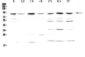 Western blot analysis of BAP1 using anti-BAP1 antibody . (BAP1 anticorps  (AA 1-278))