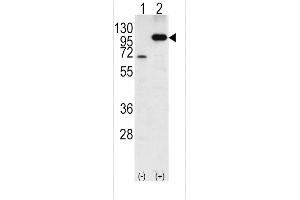 Western blot analysis of P (arrow) using rabbit polyclonal P Antibody (C-term) 6306b.