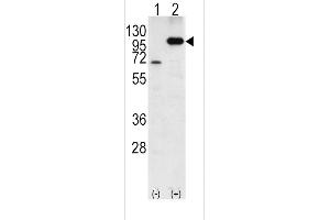 Western blot analysis of P (arrow) using rabbit polyclonal P Antibody (C-term) 6306b. (APP anticorps  (C-Term))
