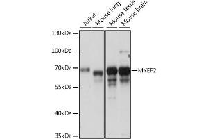 Western blot analysis of extracts of various cell lines, using MYEF2 antibody (ABIN7268721) at 1:1000 dilution. (MYEF2 anticorps  (AA 1-120))
