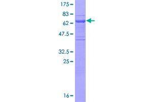 Image no. 1 for ELL Associated Factor 2 (EAF2) (AA 1-260) protein (GST tag) (ABIN1352253)