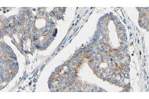 ABIN6276606 at 1/100 staining Human prostate tissue by IHC-P. (TPM3 anticorps  (N-Term))