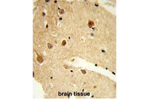 anti-Carnosine Dipeptidase 1 (Metallopeptidase M20 Family) (CNDP1) (AA 422-451), (C-Term) antibody