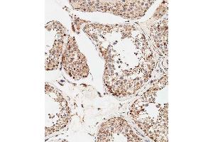 Immunohistochemical analysis of paraffin-embedded human testis tissue using B performed on the Leica® BOND RXm. (STRA8 anticorps  (C-Term))