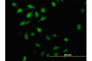 Immunofluorescence of monoclonal antibody to ID3 on HeLa cell.