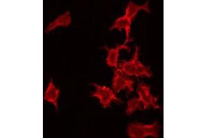 ABIN6272367 staining COLO205 by IF/ICC. (NRIP3 anticorps  (C-Term))