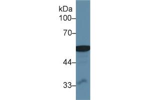 Western Blot; Sample: Human Liver lysate; Primary Ab: 1µg/ml Rabbit Anti-Human ALDM Antibody Second Ab: 0.