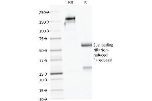 SDS-PAGE Analysis Purified AMACR / p504S Mouse Monoclonal Antibody (AMACR/1723). (AMACR anticorps)