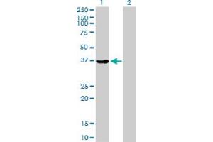 Western Blot analysis of AKR1A1 expression in transfected 293T cell line by AKR1A1 MaxPab polyclonal antibody. (AKR1A1 anticorps  (AA 1-325))