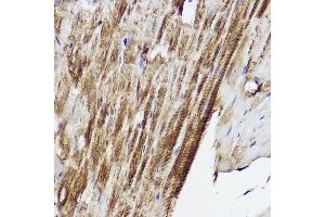 Immunohistochemistry of paraffin-embedded mouse heart using PLOD3 Rabbit pAb (ABIN6130652, ABIN6145791, ABIN6145792 and ABIN6214834) at dilution of 1:50 (40x lens). (PLOD3 anticorps  (AA 25-280))