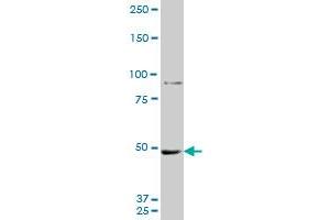 MTA1 monoclonal antibody (M10A), clone 1C3. (MTA1 anticorps  (AA 601-700))