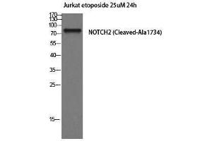 Western Blotting (WB) image for anti-Notch 2 (NOTCH2) (Cleaved-Ala1734), (Internal Region) antibody (ABIN3181820) (NOTCH2 anticorps  (Cleaved-Ala1734, Internal Region))