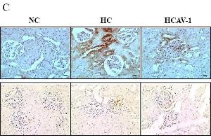 CAV-1 preserves mitochondrial morphology and reduces mitochondrial biogenesis.
