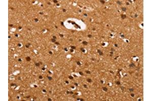 The image on the left is immunohistochemistry of paraffin-embedded Human brain tissue using ABIN7190032(CABLES2 Antibody) at dilution 1/25, on the right is treated with synthetic peptide. (CABLES2 anticorps)