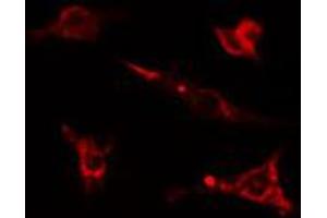 ABIN6274588 staining Hela cells by IF/ICC. (beta Arrestin 1 anticorps  (C-Term))