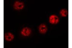 ABIN6272436 staining HT29 by IF/ICC.