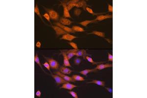 Immunofluorescence analysis of NIH-3T3 cells using p70 S6 Kinase 2 Rabbit mAb (ABIN7270034) at dilution of 1:100 (40x lens).
