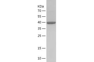 Western Blotting (WB) image for Calreticulin (CALR) (AA 25-199) protein (His-IF2DI Tag) (ABIN7122109)