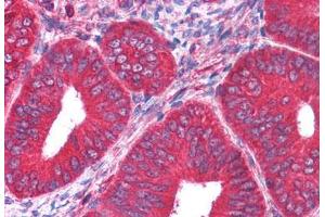 anti-Pyruvate Kinase, Muscle (PKM) antibody